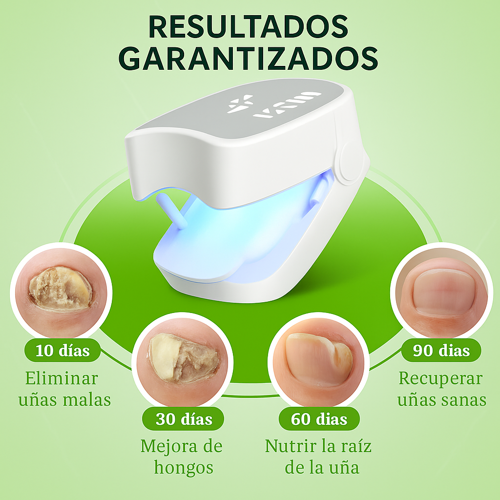 LaserFeet Pro® | Elimina hongos de las uñas sin dolor y desde casa