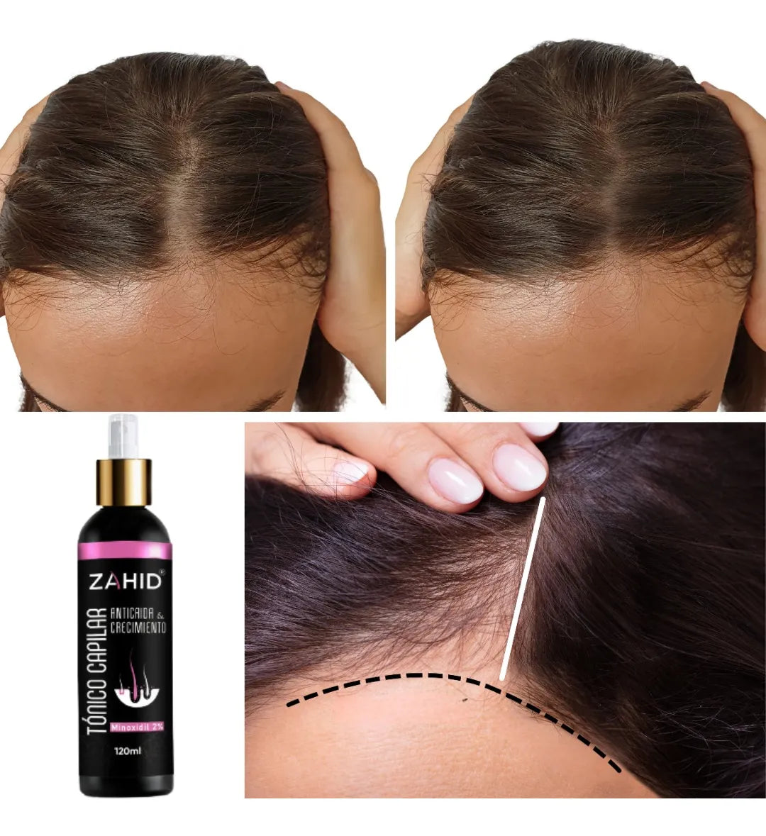 Kit Capilar Fortalecedor ZAHID. Shampoo + Tonico 2x1
