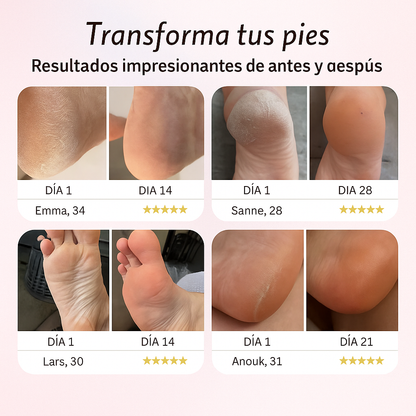 Lima Eléctrica para Pies – Pies Suaves sin Salón, en Casa