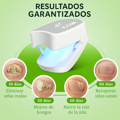 LaserFeet Pro® | Elimina hongos de las uñas sin dolor y desde casa
